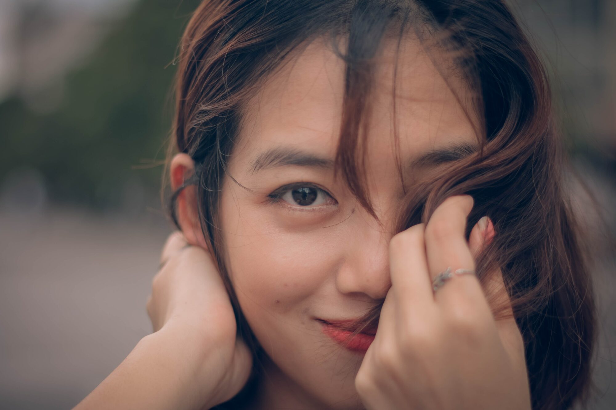 Injecter les cernes creux avec l'acide hyaluronique en Medecine Esthetique 2 Injecter les cernes creux avec l'acide hyaluronique en Medecine Esthetique Clinique Rivoli Massena 2