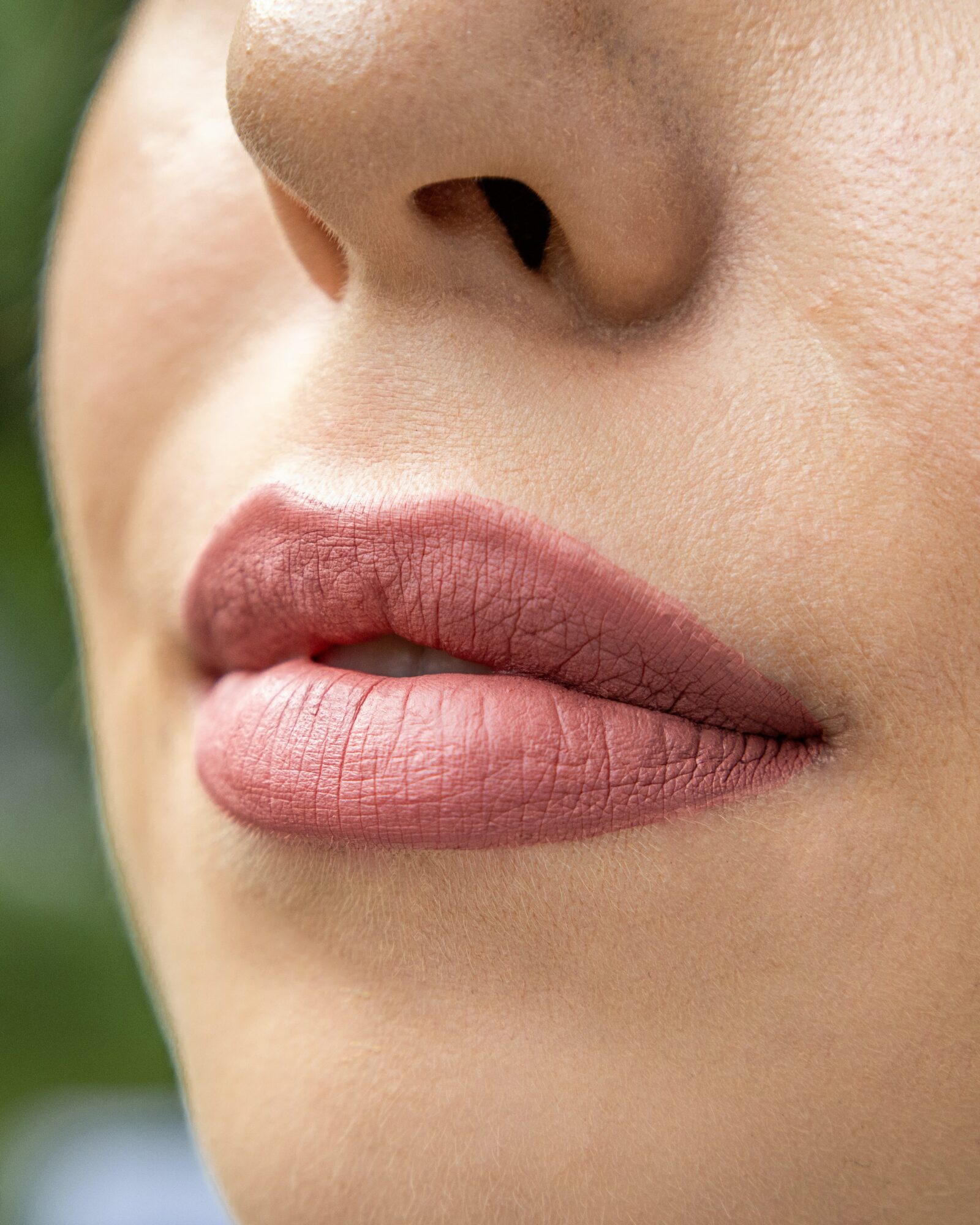 Injecter les rides autour de la bouche au naturel Clinique Rivoli Massena 2