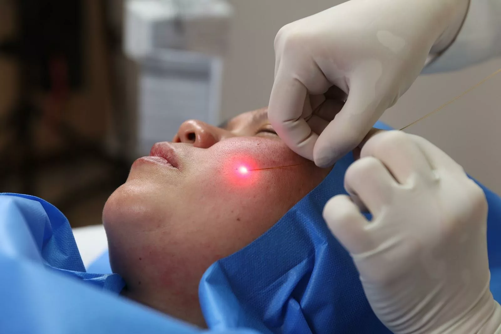 L'Endolfting par laser en Médecine Esthétique Clinique Rivoli Massena 2