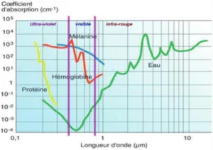 L'Endo lifting par laser en Médecin Esthétique Clinique Rivoli Massena 4