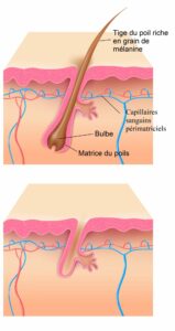 l'épilation laser des jambes Clinique Rivoli Massena 2 