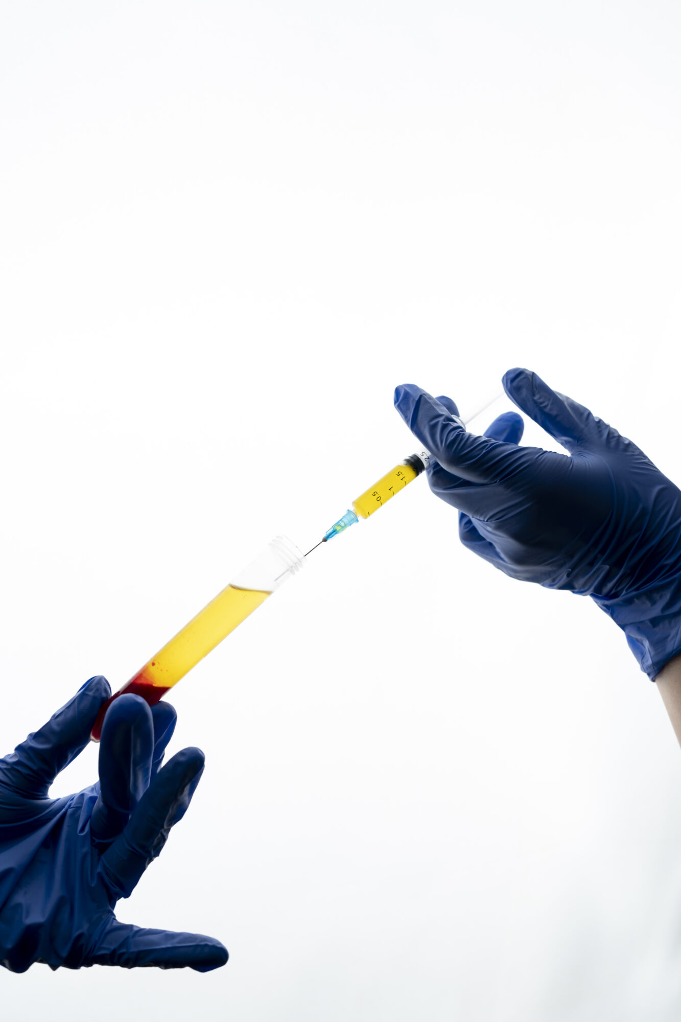 Mésothérapie capillaire PRP cheveux comment choisir Clinique Rivoli Massena 2 Mesotherapie capillaire PRP cheveux comment choisir Clinique Rivoli Massena 2