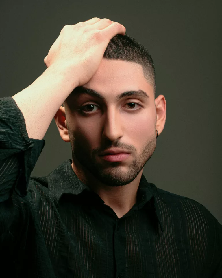 Shock loss après une greffe de cheveux Clinique Rivoli Massena 1