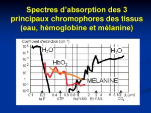 une astuce si pratique l'épilation laser en Médecine Esthétique Clinique Rivoli Massena 3