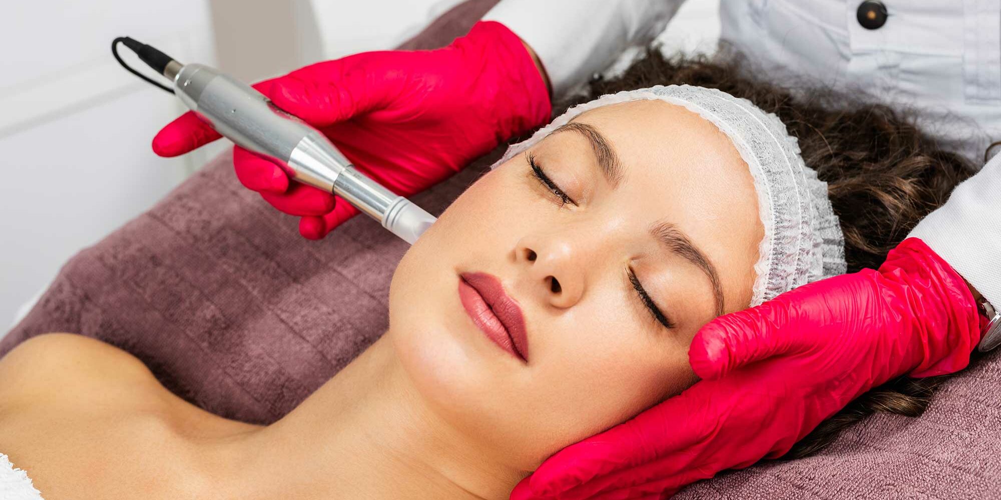 Microneedling à Strasbourg à la Clinique Rivoli Massena