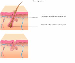 epilation laser définitive en dix questions clinique rivoli massena 3