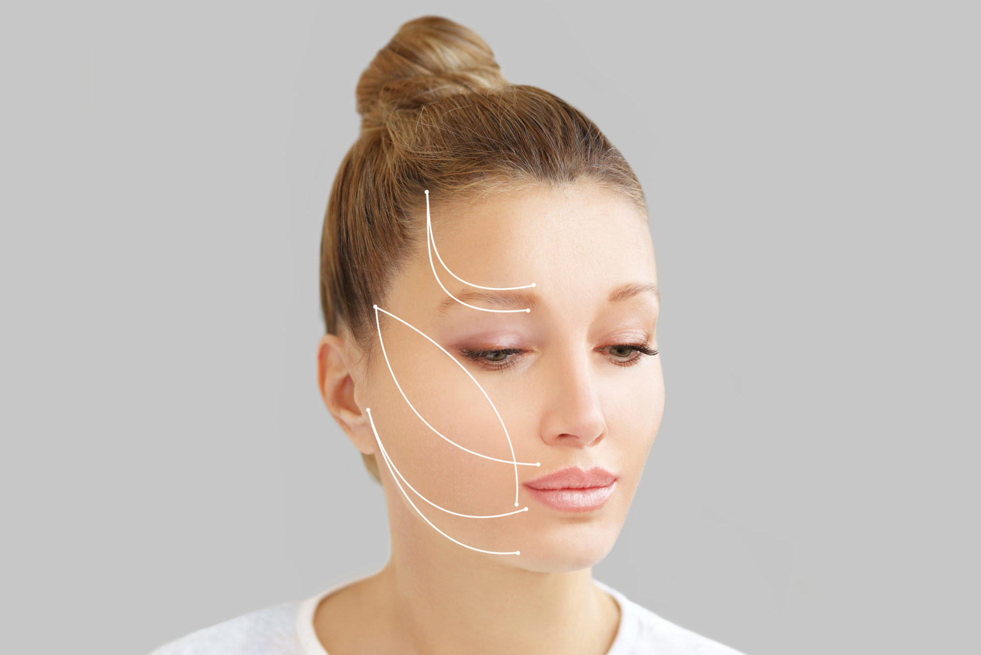 Thread Lift ,markup Fils tenseurs visage Strasbourg