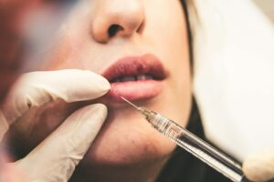 injection acide hyaluronique lèvres clinique rivoli massena 8