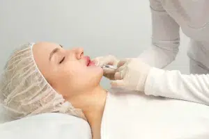Injections d’Acide Hyaluronique pour les Lèvres à Strasbourg