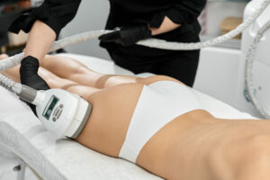 la cryolipolyse médicale la révolution du remodelage sur mesure de la silhouette sans effort Clinique Rivoli Massena 1