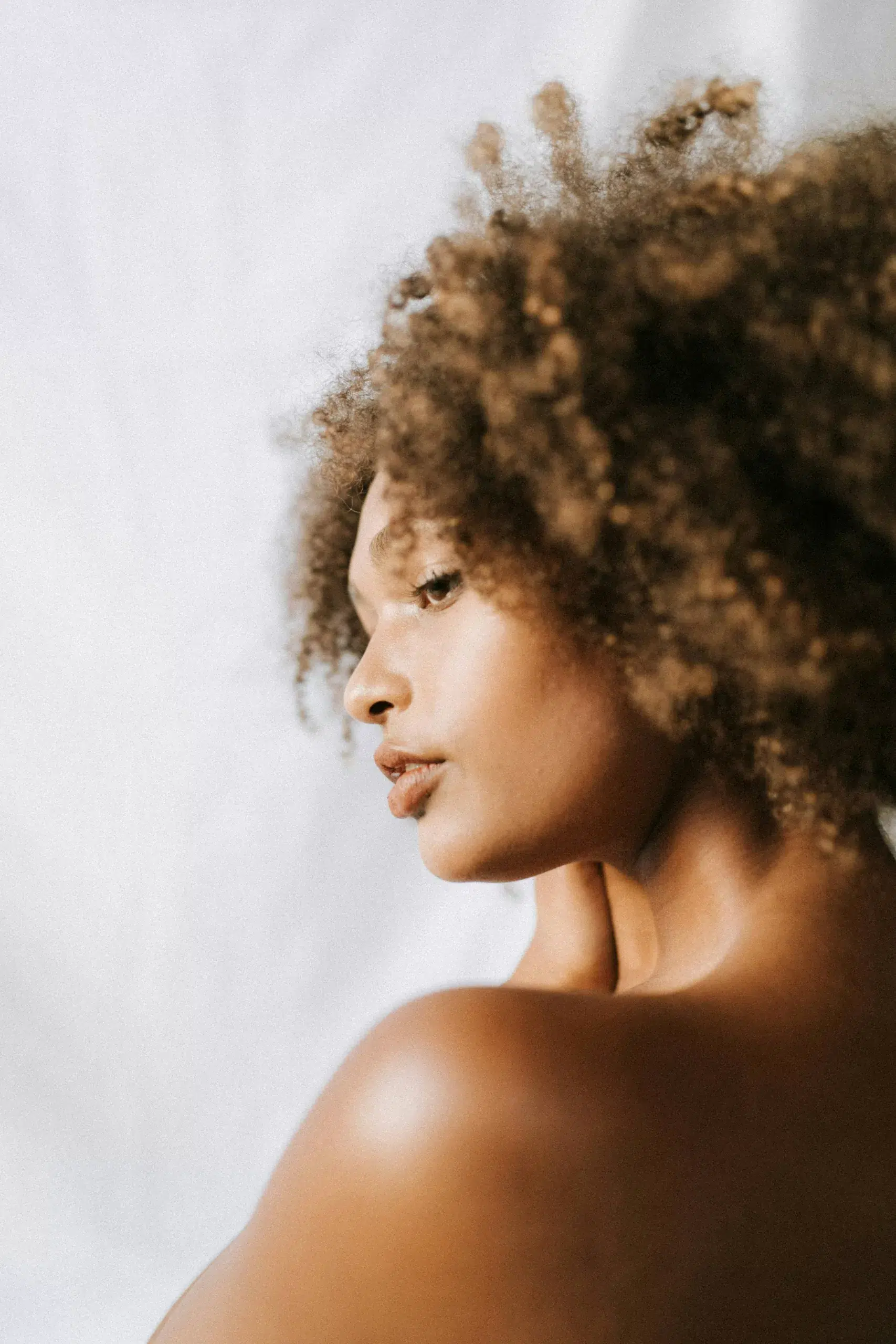 la greffe de cheveux chez la femme en Médecine Esthétique Clinique Rivoli Massena 2 la greffe de cheveux chez la femme en Médecine Esthétique Clinique Rivoli Massena 2