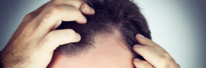 La trichopigmentation des cheveux