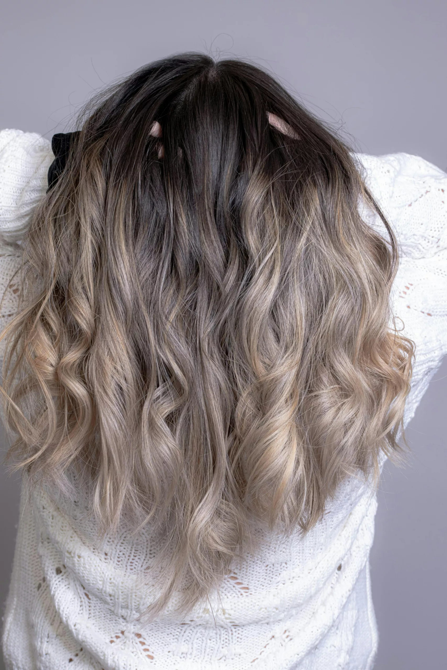 le PRP cheveux versus les polynucléotides Clinique Rivoli Massena 2