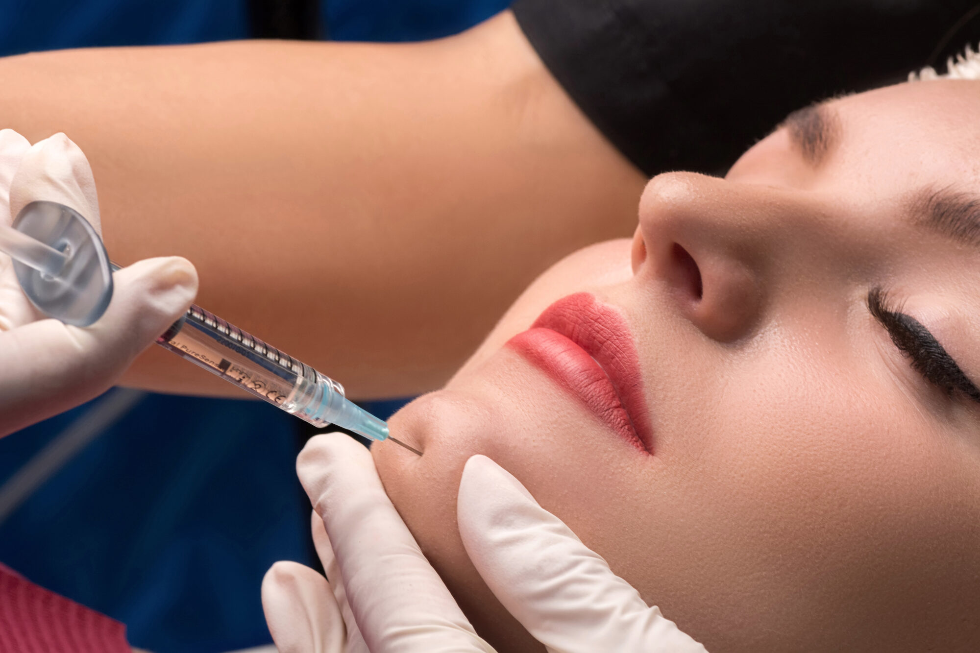Chin lipofilling. Woman getting cosmetic injection of botulinum les injections d'Acide Hyaluroniques focus sur ce qui révolutionné la Médecine Esthétique Clinique Rivoli Massena 21
