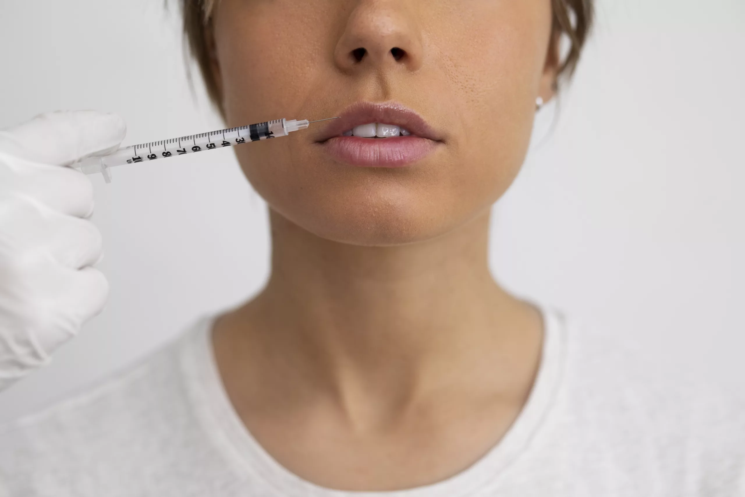 les injections d'acide hyaluronique en Médecine Esthétique Clinique Rivoli Massena 2