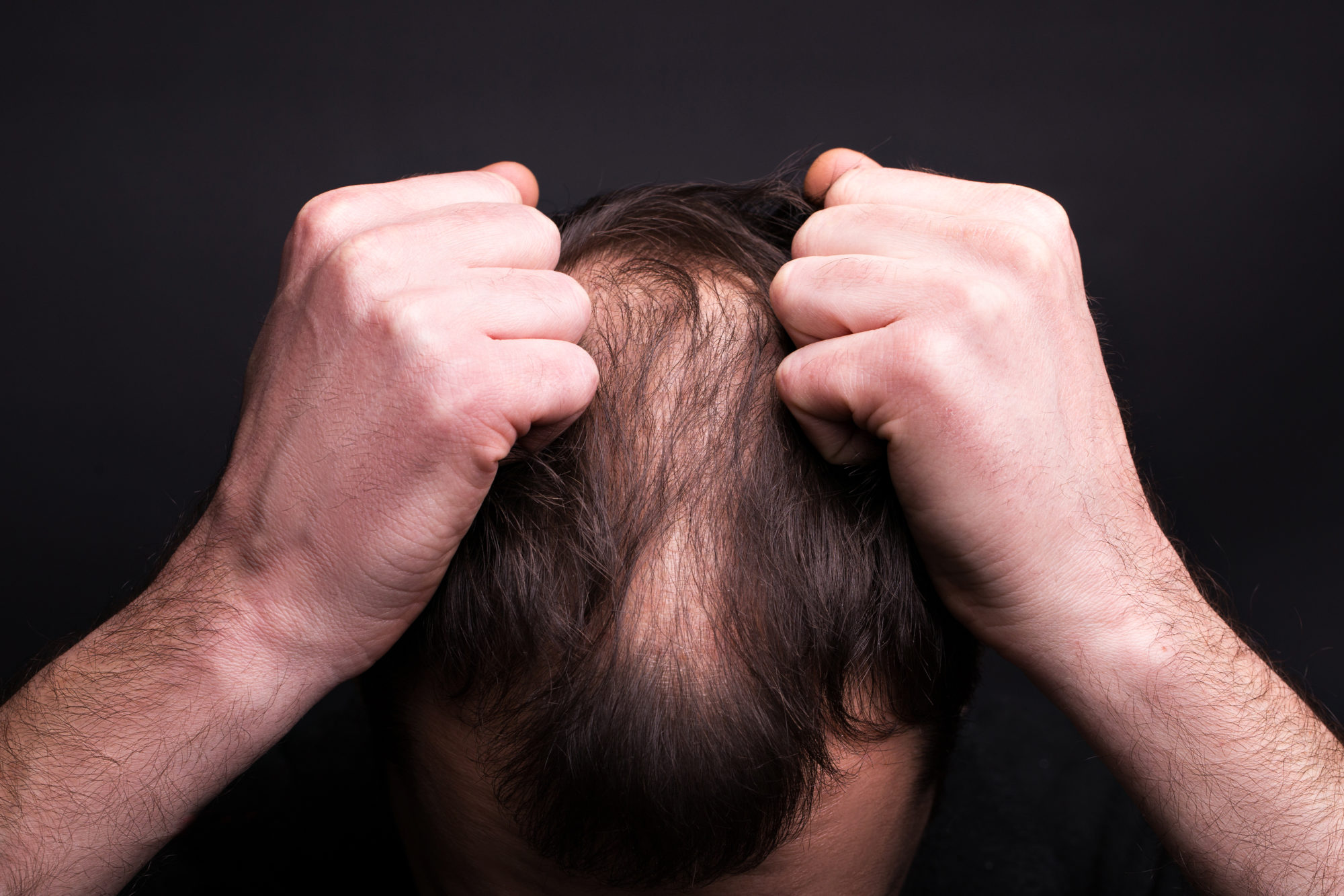 Soins anti chute de cheveux Strasbourg