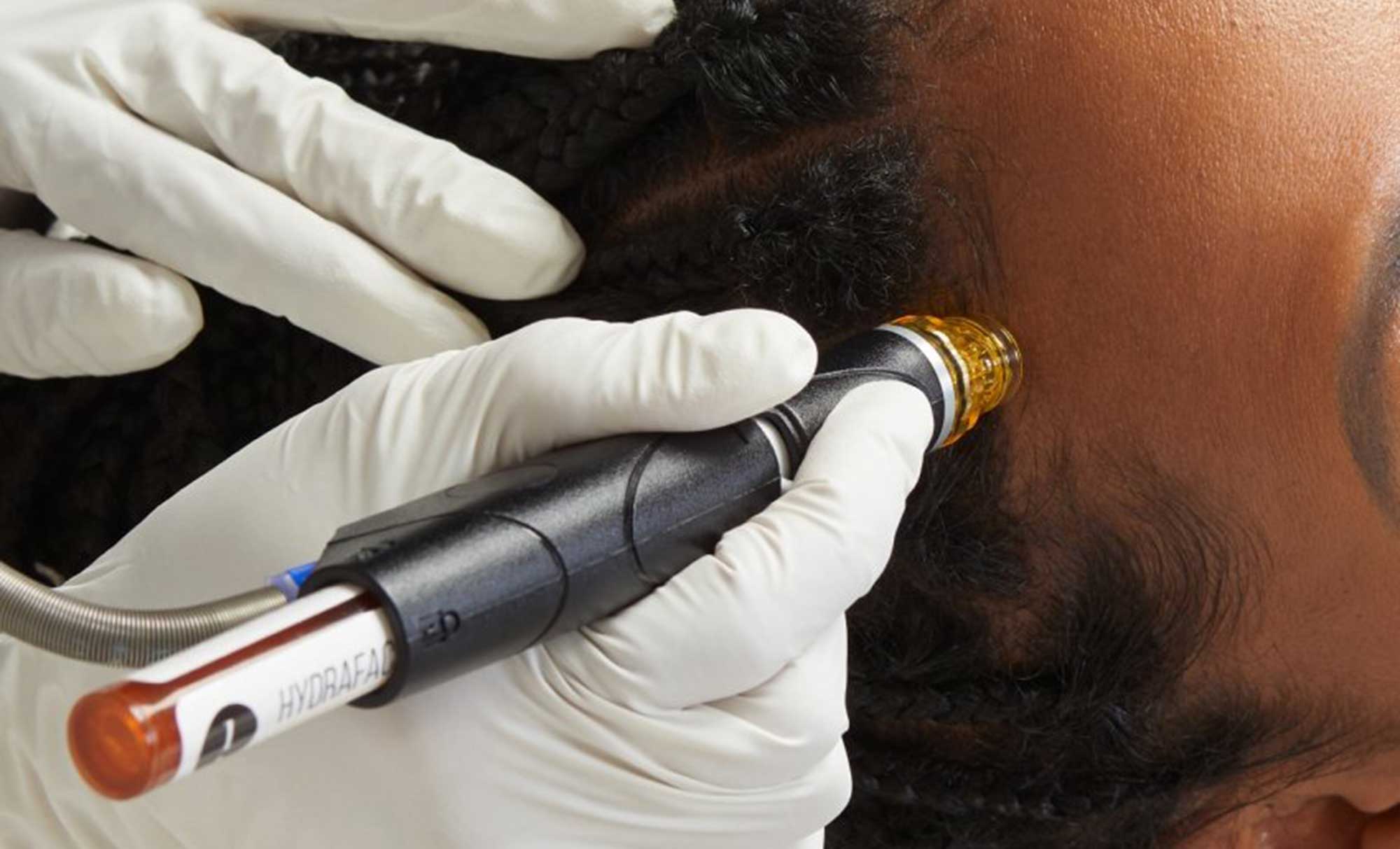 zoom-hydrafacial-keravive-strasbourg-clinique-rivoli Zoom sur l'Hydrafacial Keravive à la Clinique Rivoli Massena Strasbourg